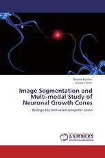 Image Segmentation and Multi-modal Study of Neuronal Growth Cones