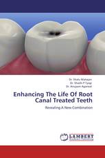 Enhancing The Life Of Root Canal Treated Teeth