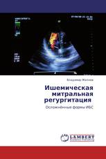 Ишемическая митральная регургитация