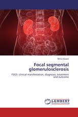 Focal segmental glomerulosclerosis