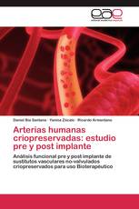 Arterias humanas criopreservadas: estudio pre y post implante