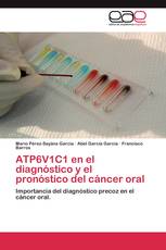 ATP6V1C1 en el diagnóstico y el pronóstico del cáncer oral