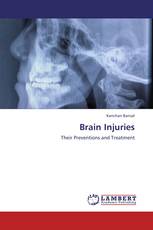 Brain Injuries