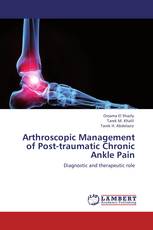 Arthroscopic Management of Post-traumatic Chronic Ankle Pain