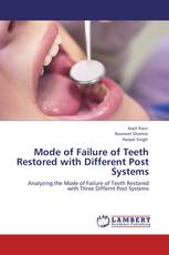 Mode of Failure of Teeth Restored with Different Post Systems