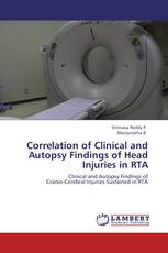 Correlation of Clinical and Autopsy Findings of Head Injuries in RTA