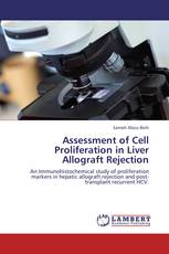 Assessment of Cell Proliferation in Liver Allograft Rejection