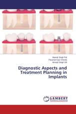 Diagnostic Aspects and Treatment Planning in Implants