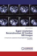 Super-resolution Reconstruction Of Cardiac MR Images