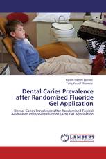 Dental Caries Prevalence after Randomised Fluoride Gel Application