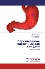 Перстневидно-клеточный рак желудка