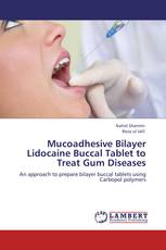 Mucoadhesive Bilayer Lidocaine Buccal Tablet to Treat Gum Diseases