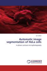 Automatic image segmentation of HeLa cells