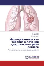 Фотодинамическая терапия в лечении центрального рака легкого