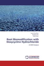 Root Biomodification with Doxycycline Hydrochloride