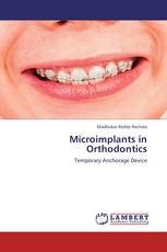 Microimplants in Orthodontics