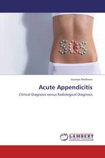 Acute Appendicitis