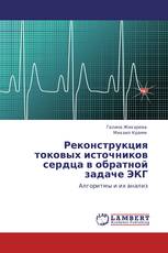 Реконструкция токовых источников сердца в обратной задаче ЭКГ