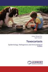 Toxocariasis
