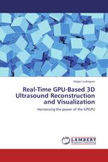 Real-Time GPU-Based 3D Ultrasound Reconstruction and Visualization