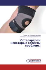 Остеоартроз: некоторые аспекты проблемы