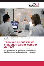 Técnicas de análisis de imágenes para el estudio de TAC.