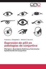 Expresión de p53 en patologías de conjuntiva