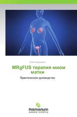            MRgFUS терапия миом матки