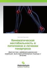 Кинематическая нестабильность в патогенезе и лечении гонартроза