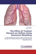 The Effect of Tracheal Stenosis on Airflow Using Numerical Modelling