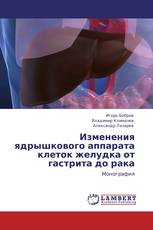 Изменения ядрышкового аппарата клеток желудка от гастрита до рака
