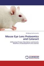 Mouse Eye Lens Proteomics and Cataract
