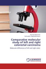 Comparative molecular study of left and right colorectal carcinoma