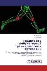 Гонартроз в амбулаторной травматологии и ортопедии