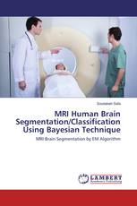 MRI Human Brain Segmentation/Classification Using Bayesian Technique