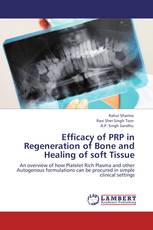 Efficacy of PRP in Regeneration of Bone and Healing of soft Tissue