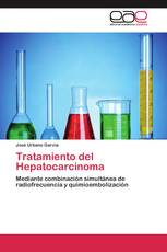Tratamiento del Hepatocarcinoma