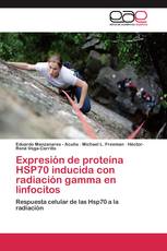 Expresión de proteína HSP70 inducida con radiación gamma en linfocitos