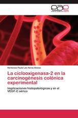 La ciclooxigenasa-2 en la carcinogénesis colónica experimental