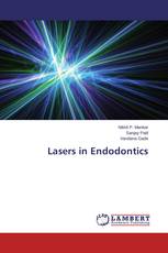 Lasers in Endodontics