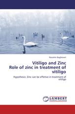 Vitiligo and Zinc  Role of zinc in treatment of vitiligo