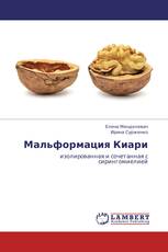 Мальформация Киари