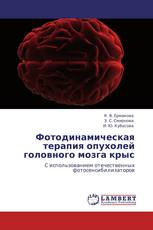 Фотодинамическая терапия опухолей головного мозга крыс