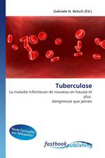 Tuberculose