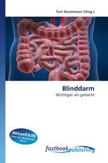 Blinddarm