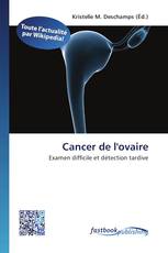 Cancer de l'ovaire