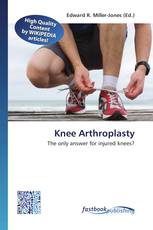 Knee Arthroplasty