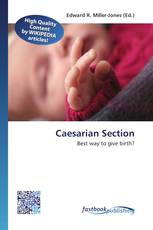 Caesarian Section