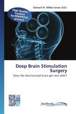 Deep Brain Stimulation Surgery