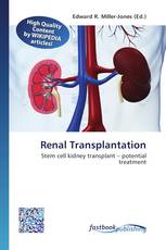 Renal Transplantation